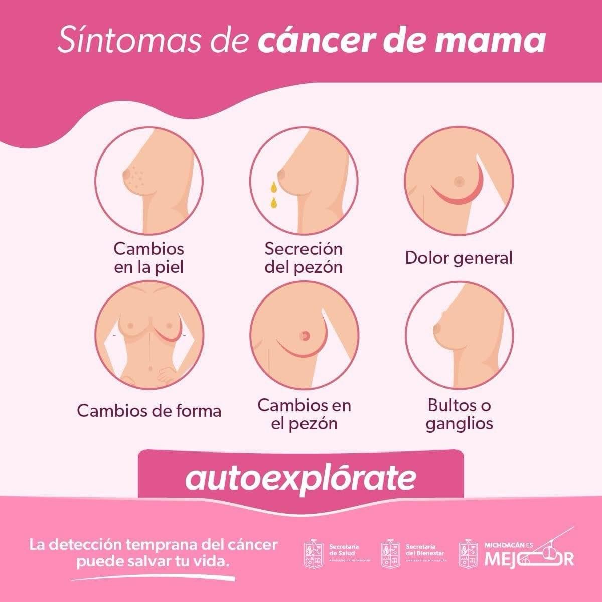 Conoce los síntomas del cáncer de mama y los hábitos saludables para prevenirlo*